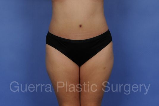 prev Case #01279 After