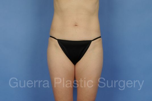 next Case #19377 Before