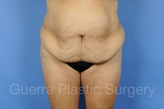 next Case #01294 Before