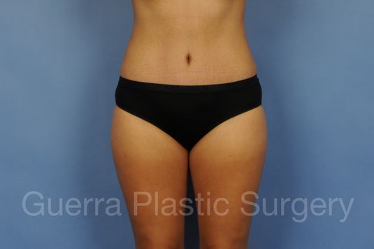 prev Case #01300 After