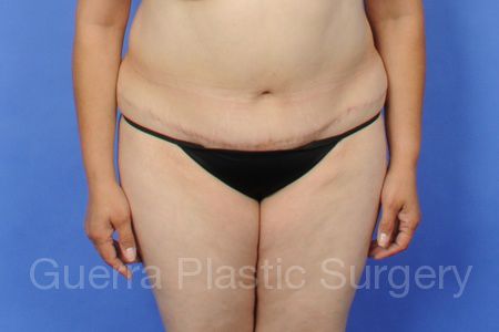 prev Case #5284 Before