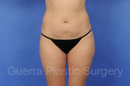 prev Case #7208 Before