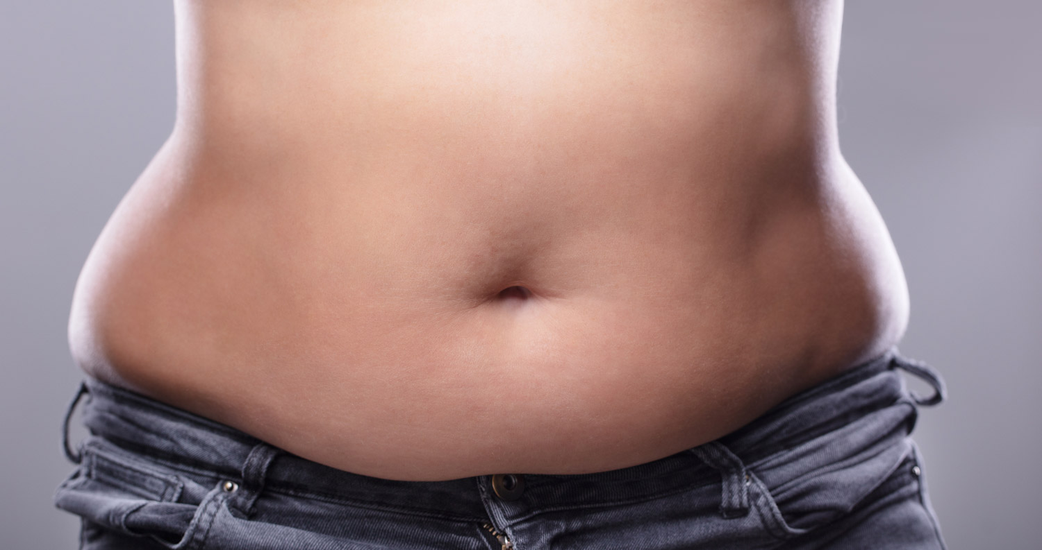 Panniculectomy vs. Tummy Tuck in Scottsdale, AZ